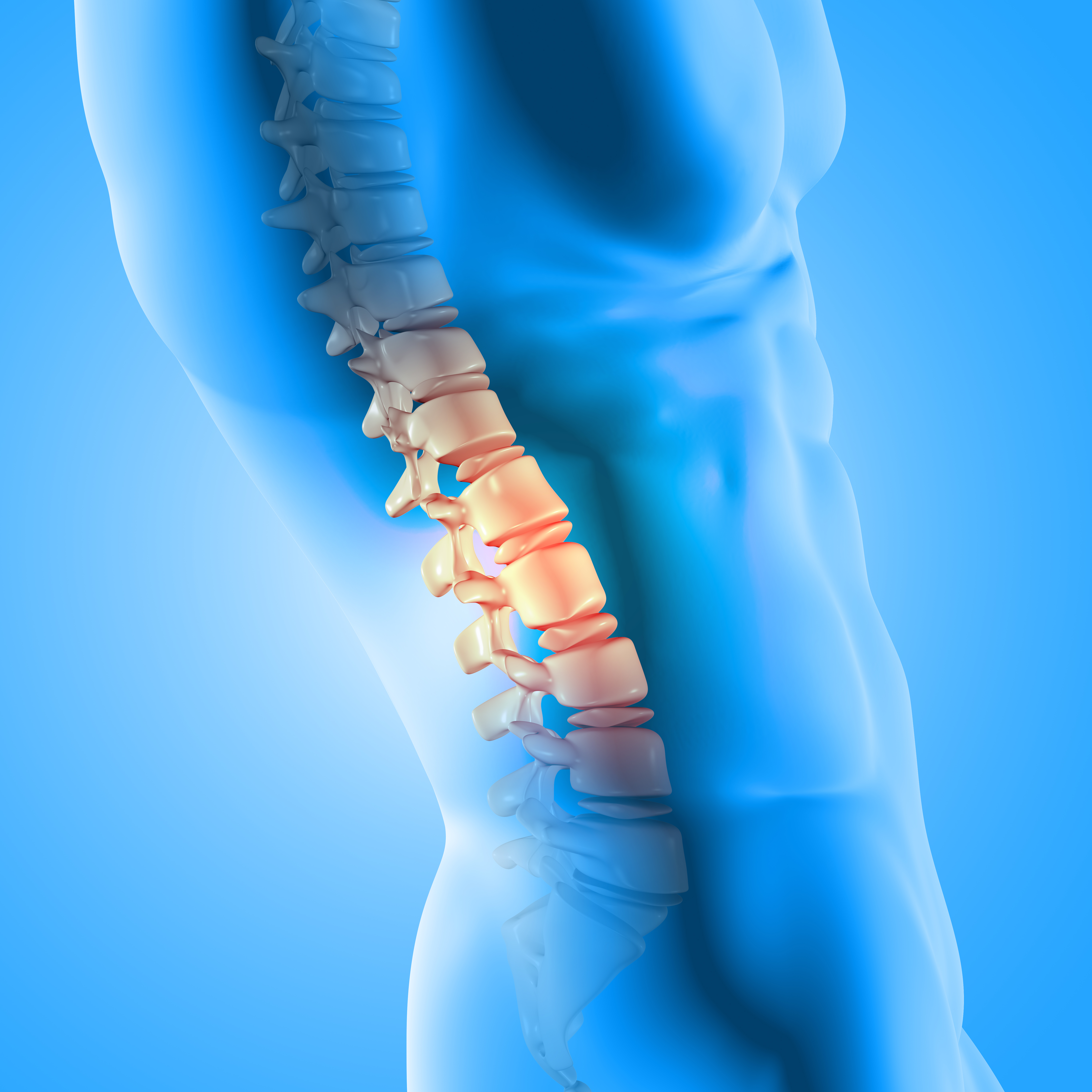 Spine Surgery